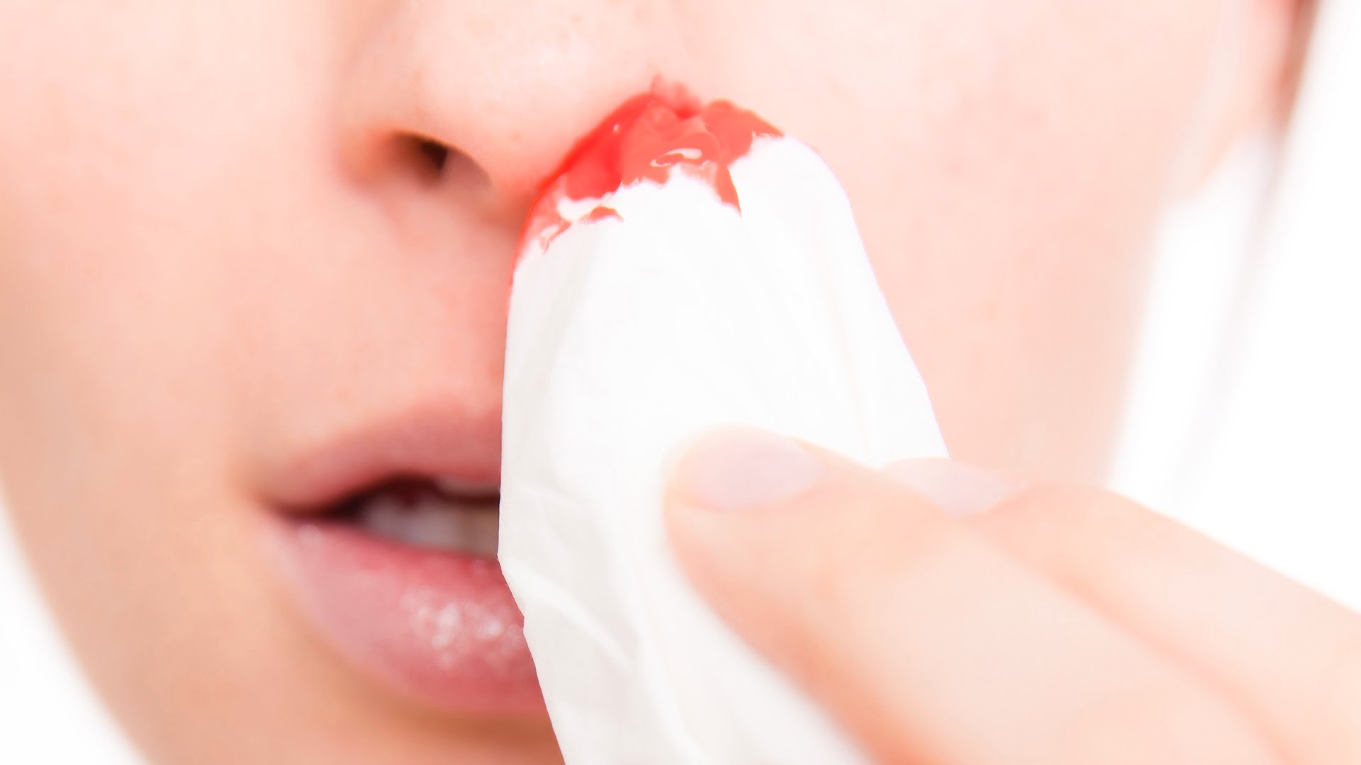 9 Methods To Make A Nosebleed On Purpose New Health Advisor