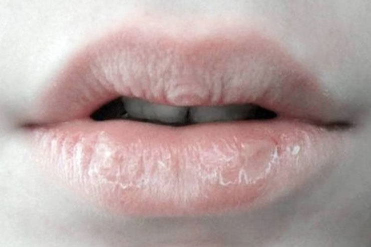 why-do-lips-get-chapped-when-you-re-sick-new-health-advisor