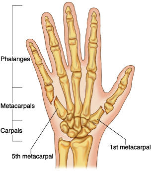 5th metacarpal fracture icd 9